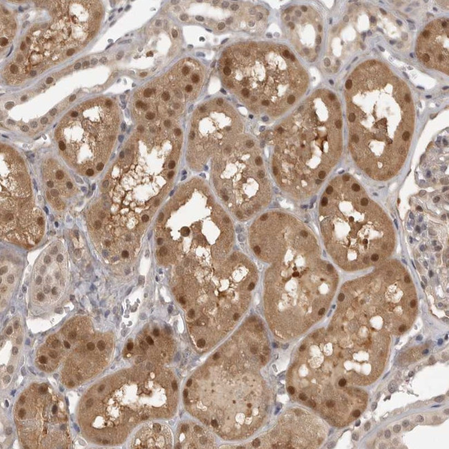 UROD Antibody in Immunohistochemistry (Paraffin) (IHC (P))
