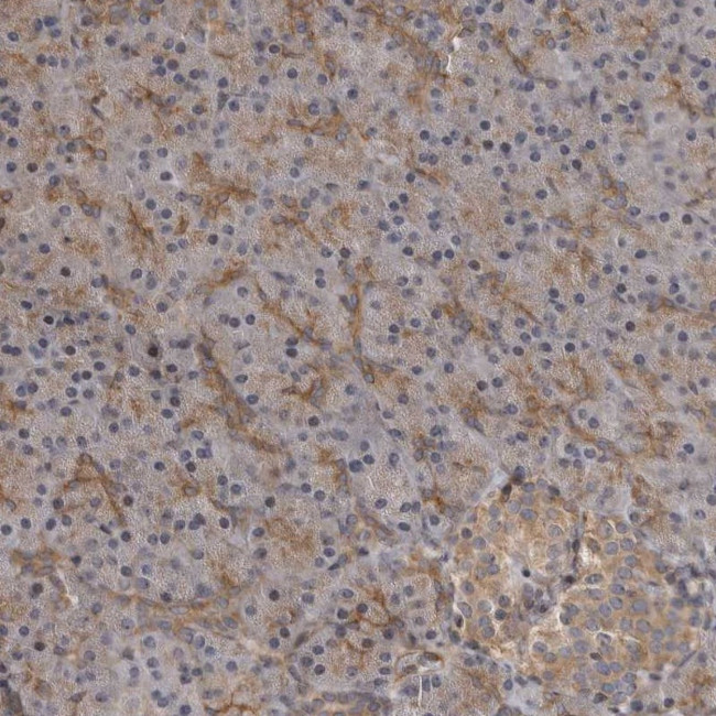 ZNRF1 Antibody in Immunohistochemistry (Paraffin) (IHC (P))