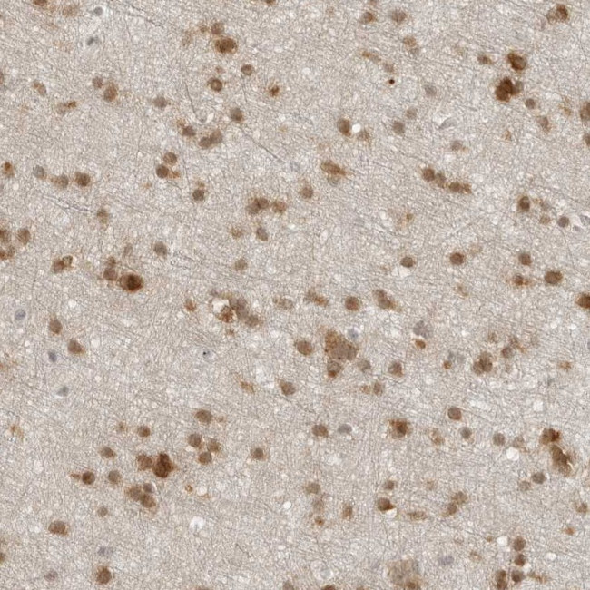 CC2D1B Antibody in Immunohistochemistry (Paraffin) (IHC (P))
