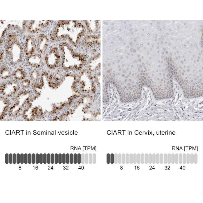 C1orf51 Antibody in Immunohistochemistry (IHC)