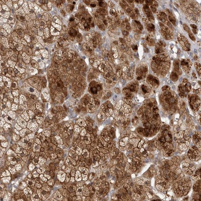 TBC1D8B Antibody in Immunohistochemistry (IHC)