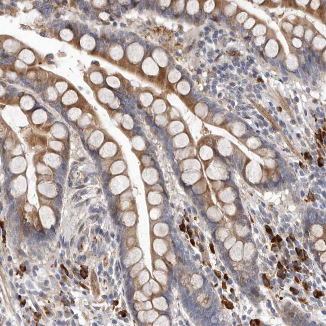 ATXN3L Antibody in Immunohistochemistry (Paraffin) (IHC (P))