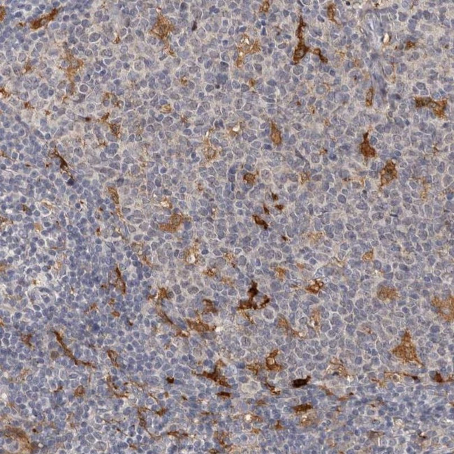 PTAFR Antibody in Immunohistochemistry (IHC)