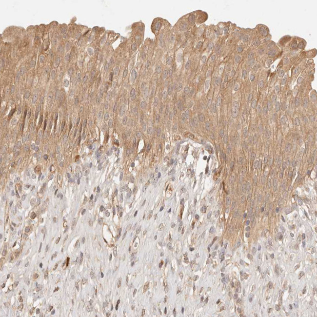 PHLDA3 Antibody in Immunohistochemistry (Paraffin) (IHC (P))