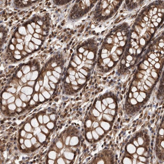 ADAMTS20 Antibody in Immunohistochemistry (Paraffin) (IHC (P))