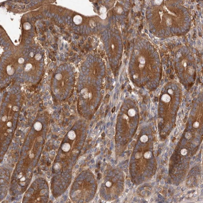 ADAMTS20 Antibody in Immunohistochemistry (Paraffin) (IHC (P))
