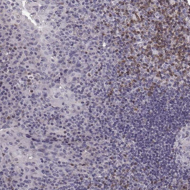 CDC42SE1 Antibody in Immunohistochemistry (IHC)