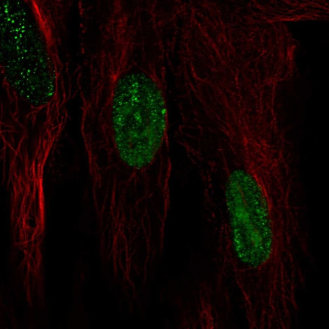 HSPB7 Antibody in Immunocytochemistry (ICC/IF)