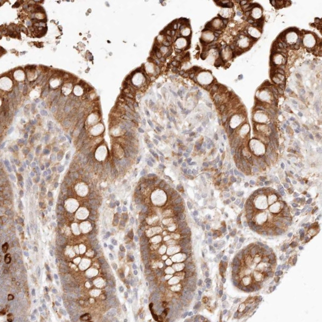 C1orf127 Antibody in Immunohistochemistry (Paraffin) (IHC (P))
