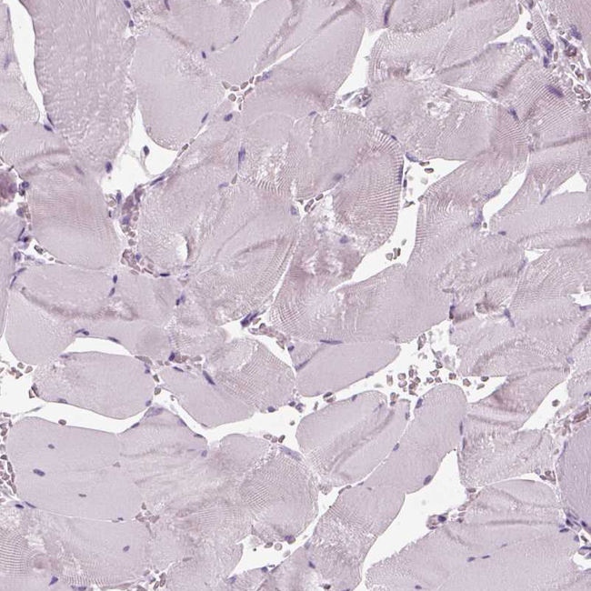 PRR9 Antibody in Immunohistochemistry (Paraffin) (IHC (P))
