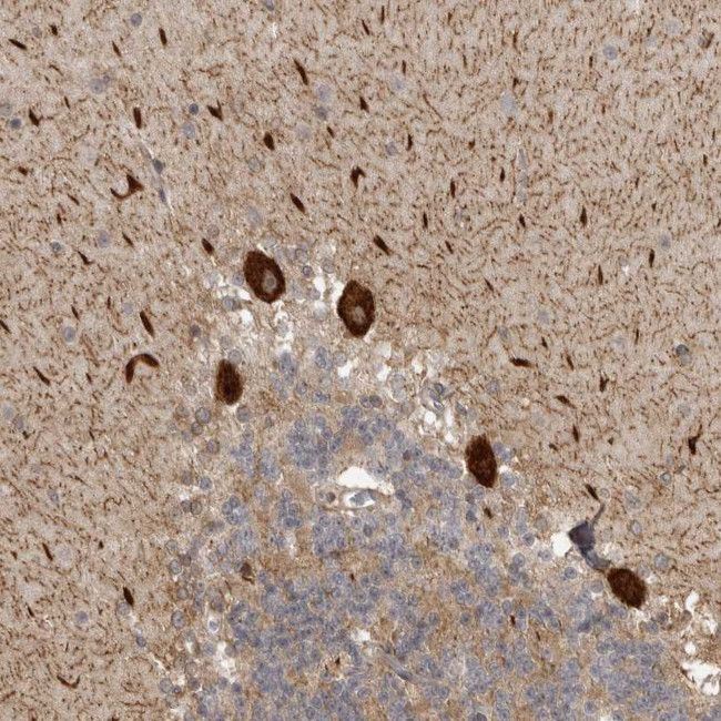 DNAH14 Antibody in Immunohistochemistry (Paraffin) (IHC (P))