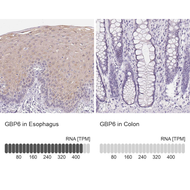GBP6 Antibody in Immunohistochemistry (IHC)