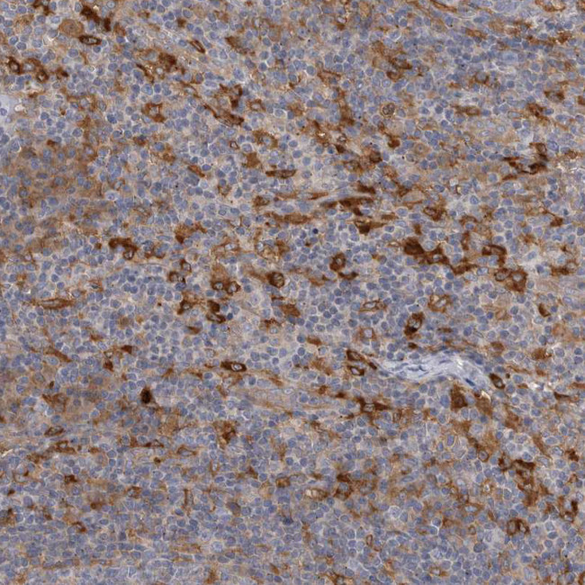 VAC14 Antibody in Immunohistochemistry (Paraffin) (IHC (P))