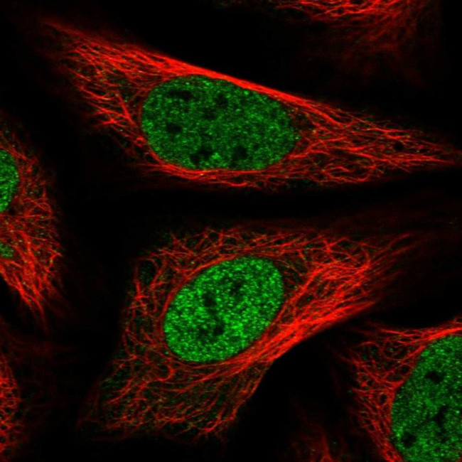 PNPO Antibody in Immunocytochemistry (ICC/IF)