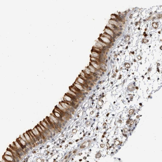 CNBD1 Antibody in Immunohistochemistry (Paraffin) (IHC (P))