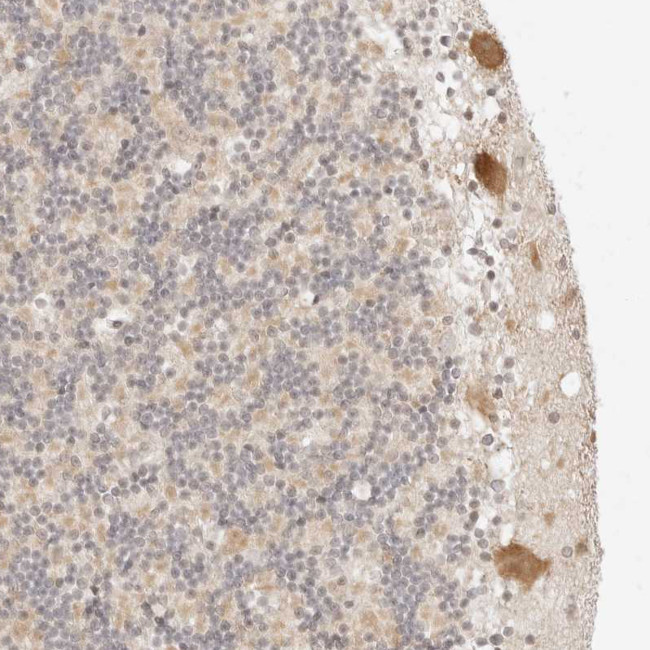 RPS6KL1 Antibody in Immunohistochemistry (Paraffin) (IHC (P))