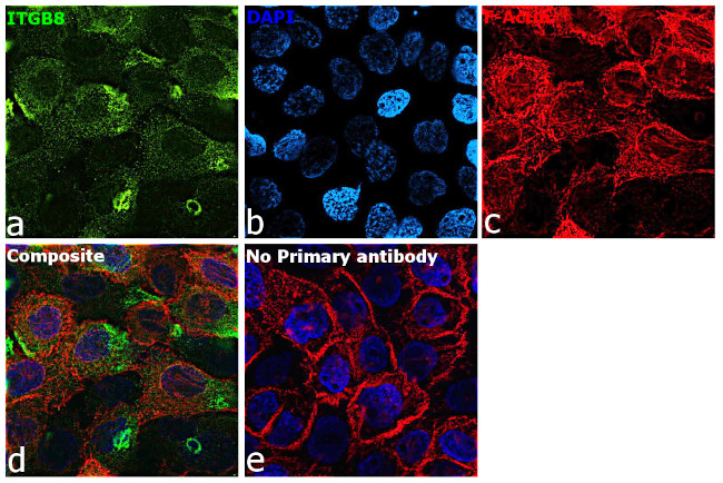 ITGB8 Antibody in Immunocytochemistry (ICC/IF)