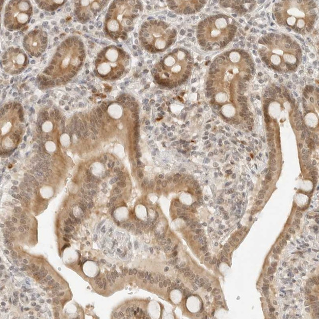 Neogenin Antibody in Immunohistochemistry (Paraffin) (IHC (P))