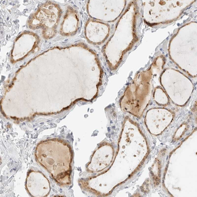 Neogenin Antibody in Immunohistochemistry (Paraffin) (IHC (P))