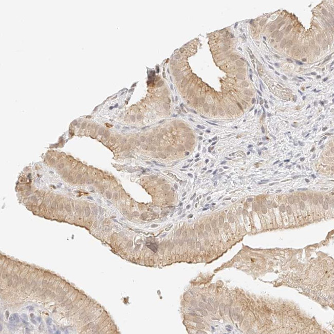 ZFP69 Antibody in Immunohistochemistry (Paraffin) (IHC (P))