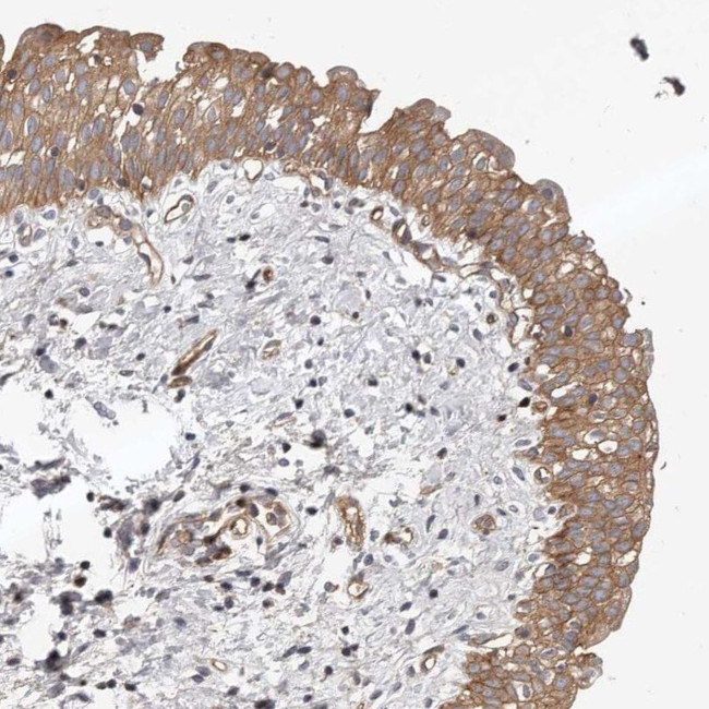 PNRC2 Antibody in Immunohistochemistry (IHC)