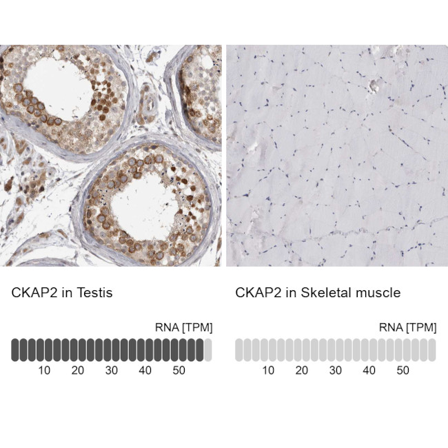 CKAP2 Antibody