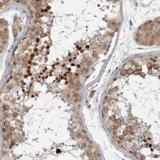 CKAP2 Antibody in Immunohistochemistry (IHC)
