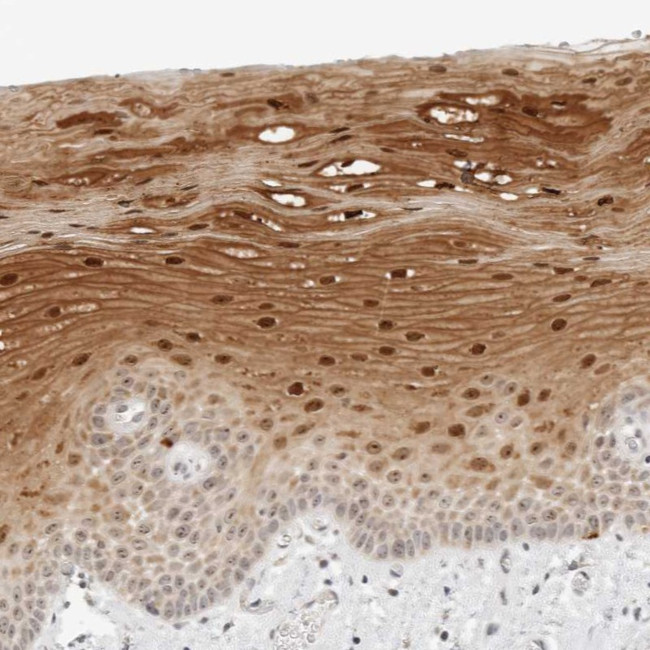 RIMKLA Antibody in Immunohistochemistry (Paraffin) (IHC (P))