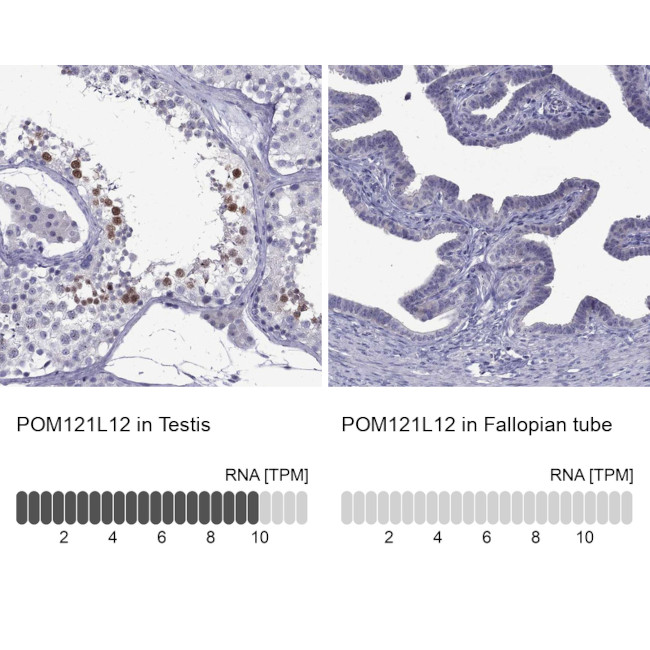 POM121L12 Antibody in Immunohistochemistry (IHC)