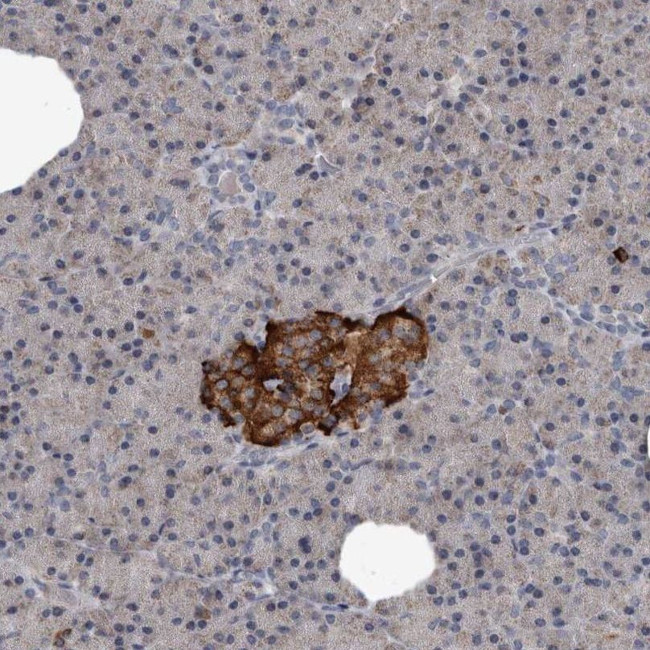 GREB1 Antibody in Immunohistochemistry (IHC)