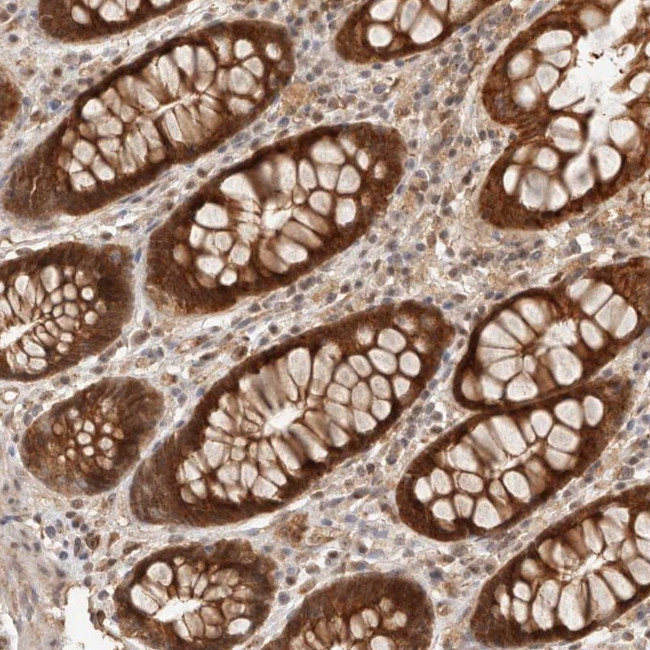 HEXDC Antibody in Immunohistochemistry (Paraffin) (IHC (P))
