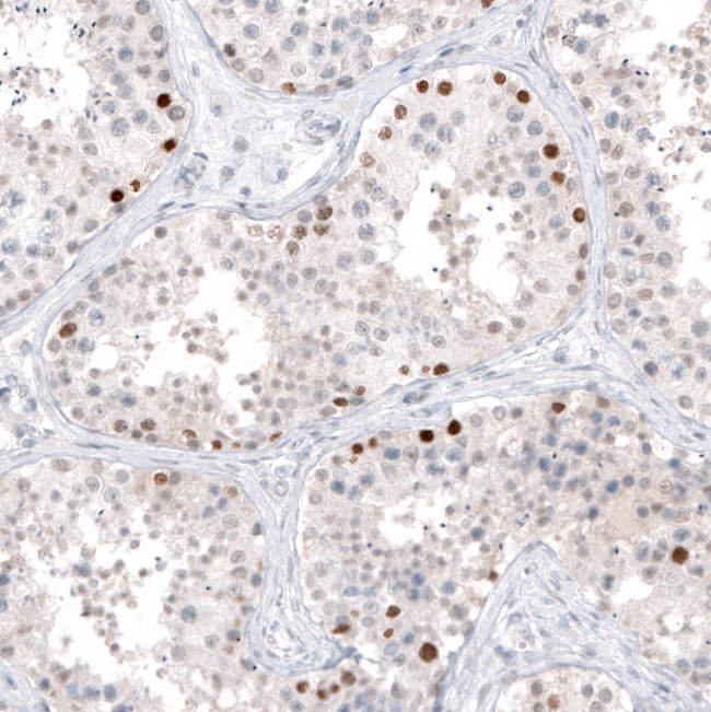 DMRT1 Antibody in Immunohistochemistry (Paraffin) (IHC (P))