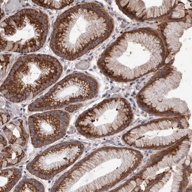 NAV1 Antibody in Immunohistochemistry (Paraffin) (IHC (P))