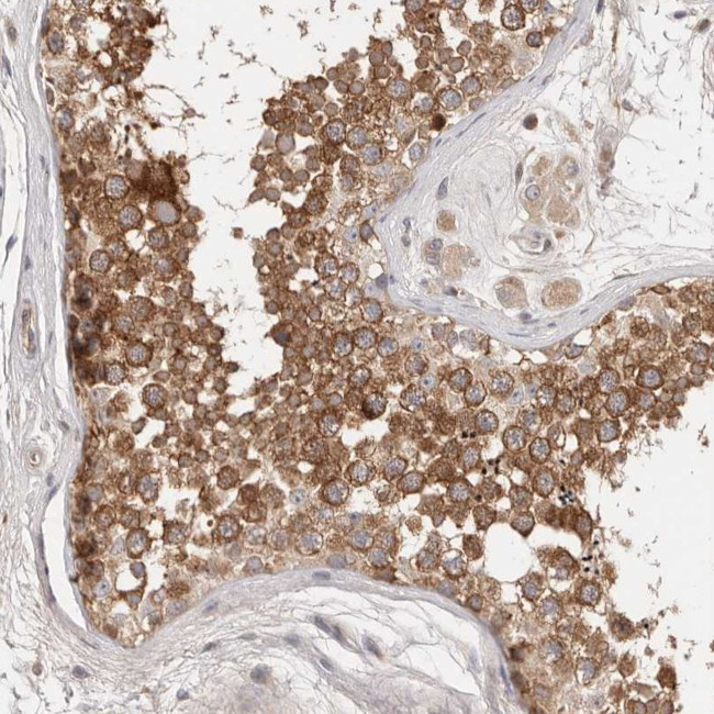 DOPEY1 Antibody in Immunohistochemistry (Paraffin) (IHC (P))