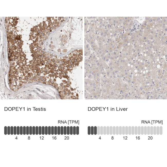DOPEY1 Antibody in Immunohistochemistry (IHC)