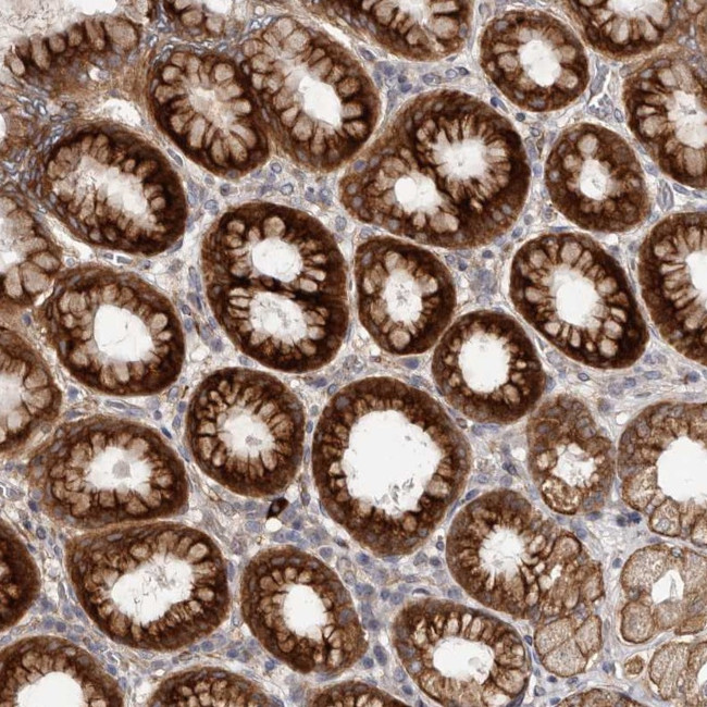 TBC1D22B Antibody in Immunohistochemistry (Paraffin) (IHC (P))
