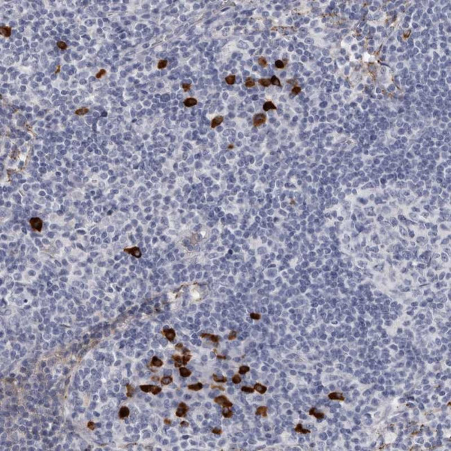 TBC1D22B Antibody in Immunohistochemistry (Paraffin) (IHC (P))