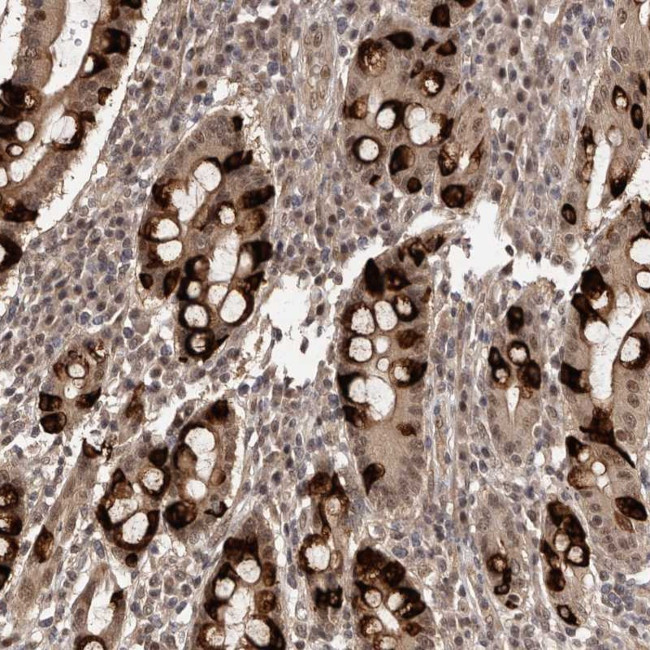 TBC1D22B Antibody in Immunohistochemistry (Paraffin) (IHC (P))