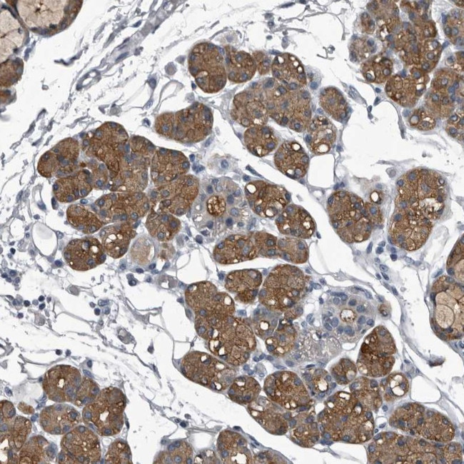 TPD52L1 Antibody in Immunohistochemistry (Paraffin) (IHC (P))