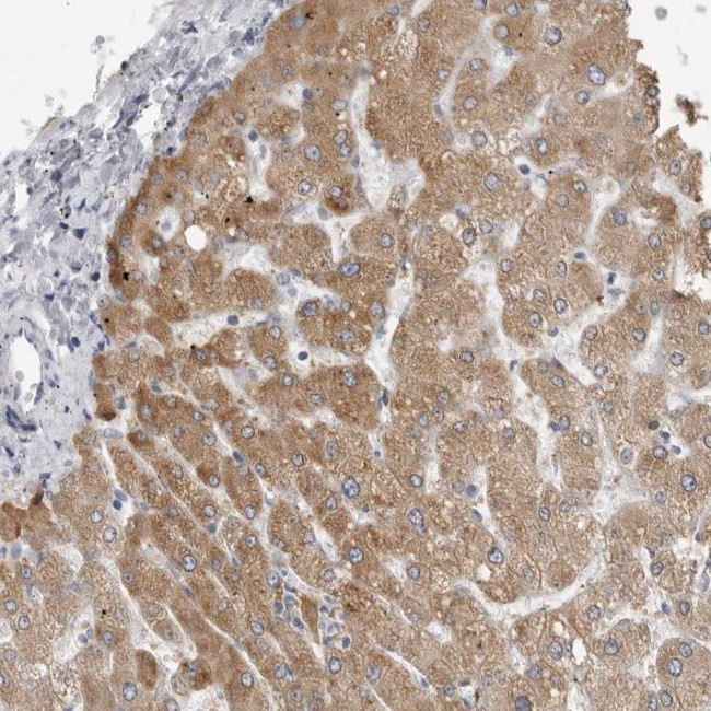 PRSS38 Antibody in Immunohistochemistry (Paraffin) (IHC (P))