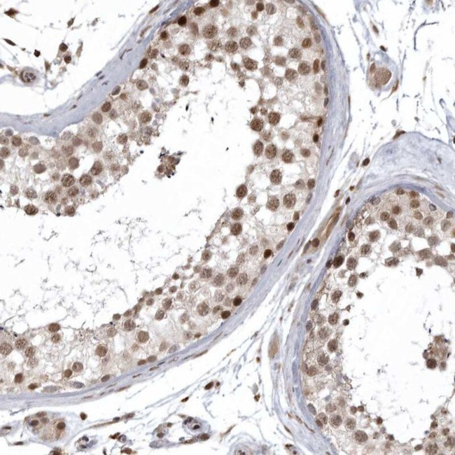 ISG20L2 Antibody in Immunohistochemistry (IHC)