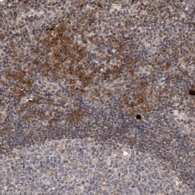 DTL Antibody in Immunohistochemistry (Paraffin) (IHC (P))