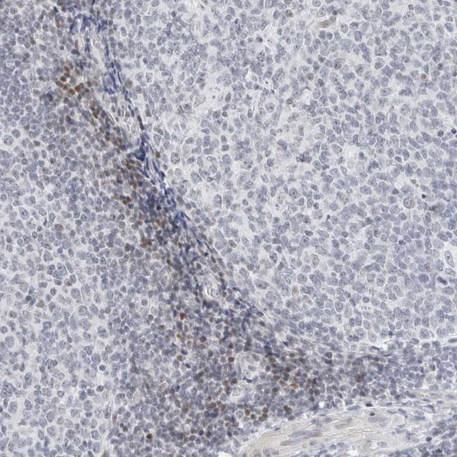 METTL11B Antibody in Immunohistochemistry (IHC)