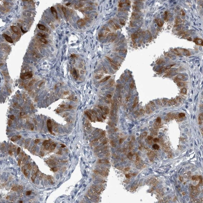 LRRC6 Antibody in Immunohistochemistry (Paraffin) (IHC (P))
