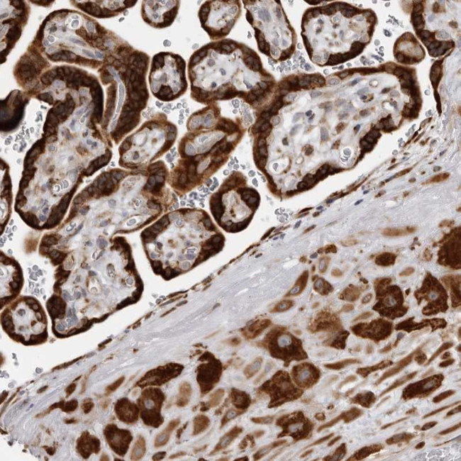ALPK2 Antibody in Immunohistochemistry (Paraffin) (IHC (P))