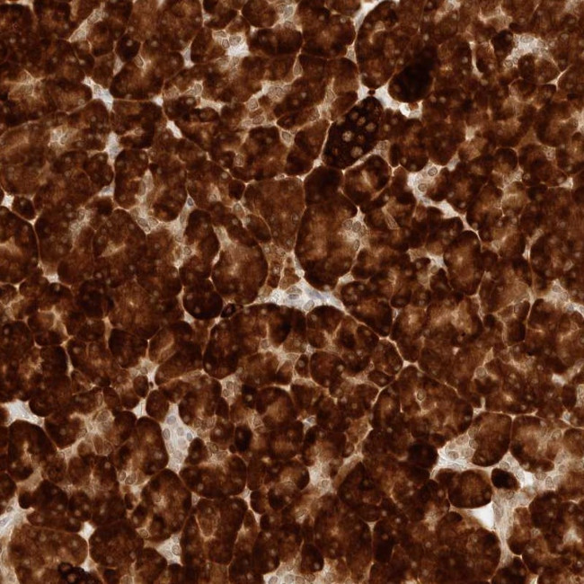 ERO1LB Antibody in Immunohistochemistry (Paraffin) (IHC (P))