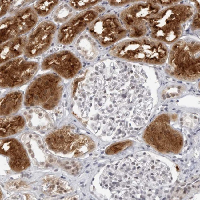 RAB11FIP3 Antibody in Immunohistochemistry (Paraffin) (IHC (P))