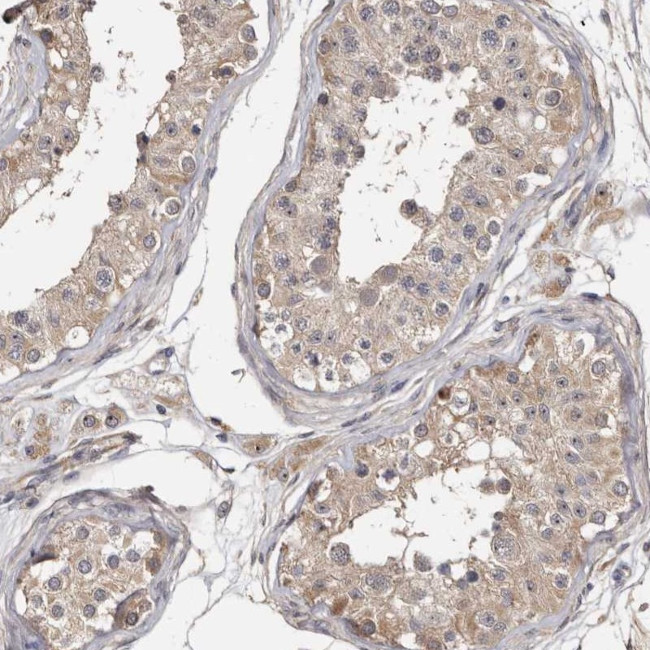 TTC39A Antibody in Immunohistochemistry (Paraffin) (IHC (P))