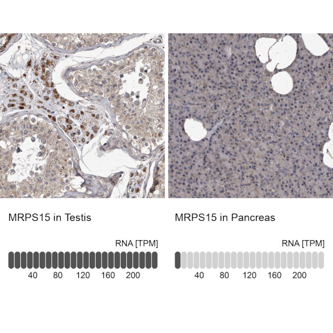 MRPS15 Antibody in Immunohistochemistry (IHC)