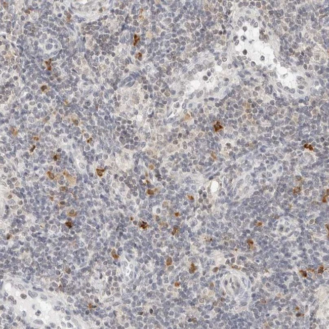 PARP10 Antibody in Immunohistochemistry (IHC)